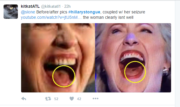 hillary_tongue