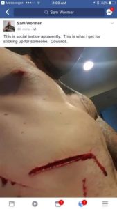 facebook stabbed stomach