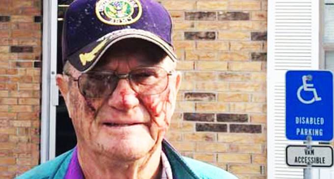 Police Severly Beat 80-Year-Old Man Who Was Complaining About Utility Crew On His Property