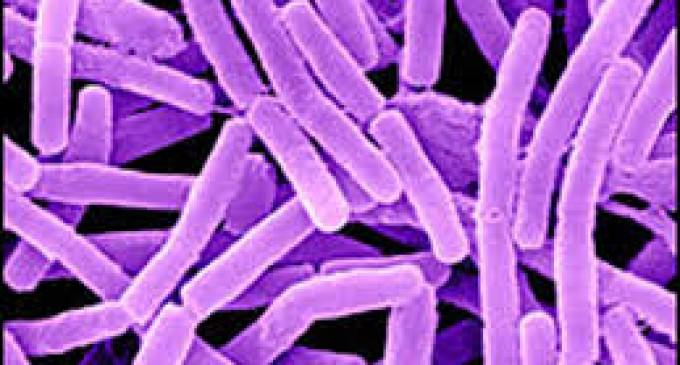 Oops. Anthrax Distribution in U.S.A. Shockingly Common