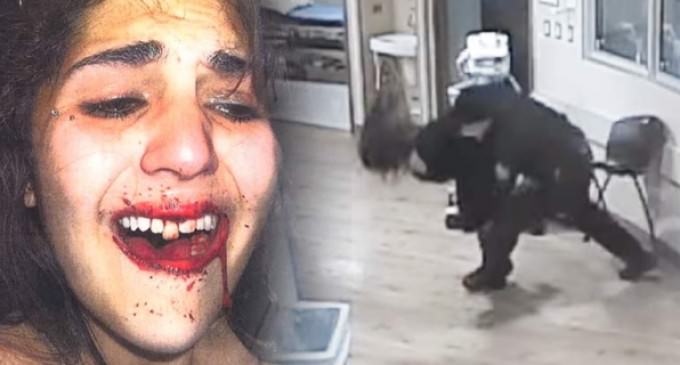 Colorado Cop Slams Handcuffed Teen Into Concrete Floor, Knocking Her Teeth Out