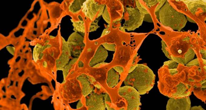 Deadly Antibiotic-resistant Superbug Spreads