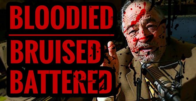 Michael Savage Assaulted by Anti-Trump Lunatic in California