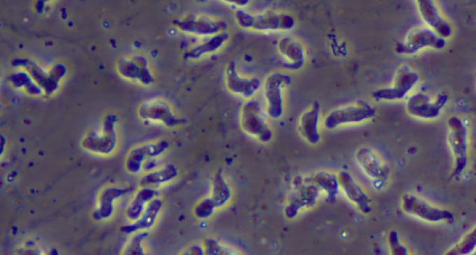 Brain-Eating Amoeba Found in Louisiana Water Systems